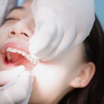 矯正治療で抜歯が必要な理由