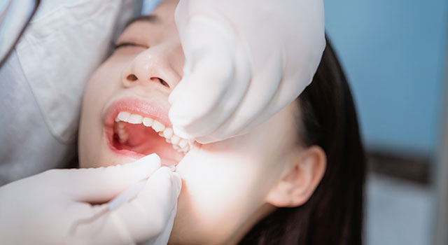 矯正治療で抜歯が必要な理由