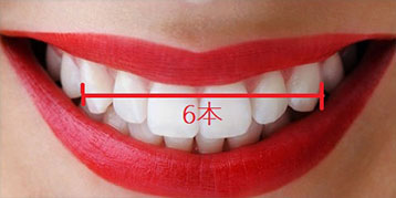 ジルコニアセラミック6本セット