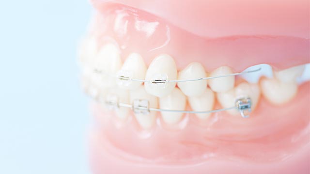 矯正の器具が当たるときの痛み