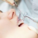 歯を綺麗にクリーニングするPMTCとは?