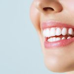 歯の着色（ステイン）について