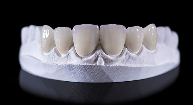 セラミックとジルコニアの違いをご存じですか？