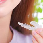 インビザラインにも種類があるのをご存じですか？