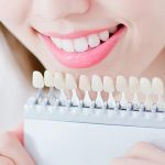 矯正治療と同時にホワイトニングを施術する事は可能なの？