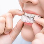 格安マウスピース矯正の真実とは？トラブルが多い格安矯正への警鐘