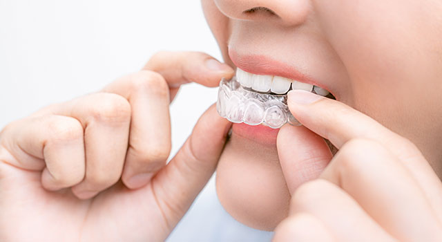 格安マウスピース矯正の真実とは?トラブルが多い格安矯正への警鐘