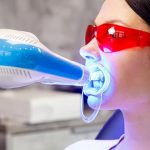 ホワイトニングは歯に良くないって本当？リスクや注意点をご紹介