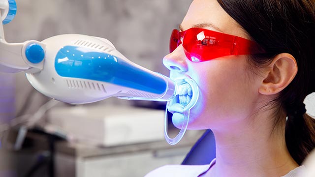 ホワイトニングは歯に良くないって本当？リスクや注意点をご紹介