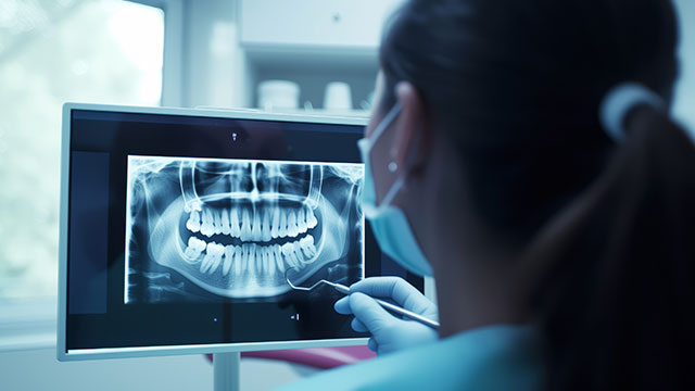 矯正歯科のハイアングルケース・ローアングルケースについて