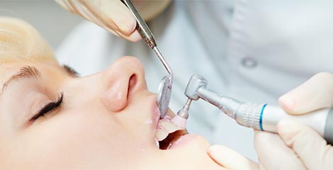 専用ペーストによる細かいクリーニング