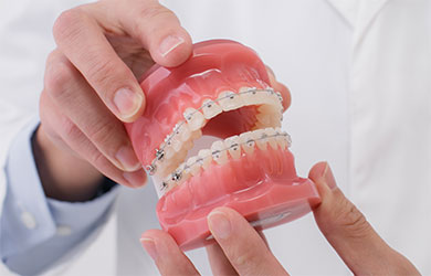 矯正治療スタート