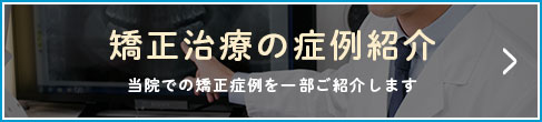 矯正治療の症例紹介