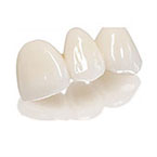 ジルコニアセラミック