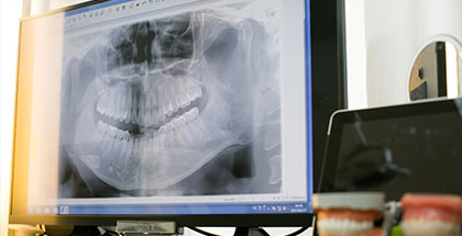 幅広い症例に対応できる