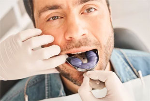 お口の状態の型取り