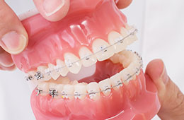 部分的にワイヤーを用いてリカバリー